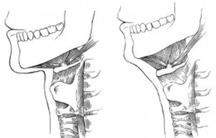 Position osseuse du cou