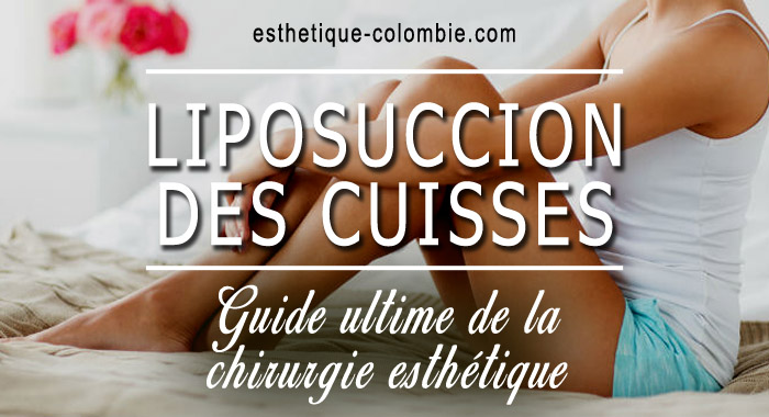guide-liposuccion-cuisses