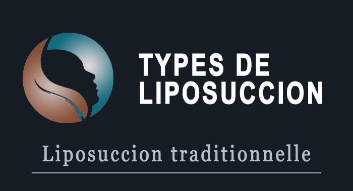 liposuccion-traditionnelle