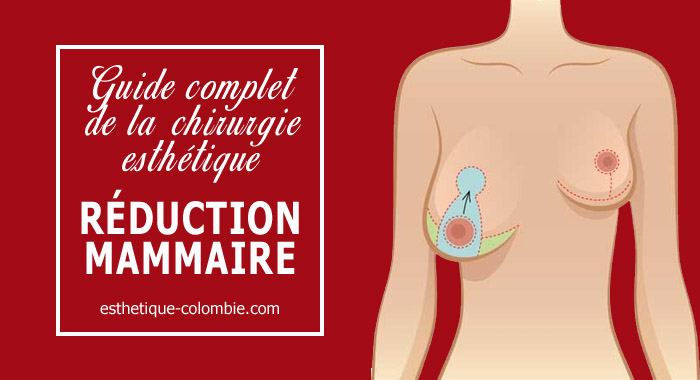 -reduction-mammaire