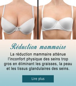 Réduction mammaire