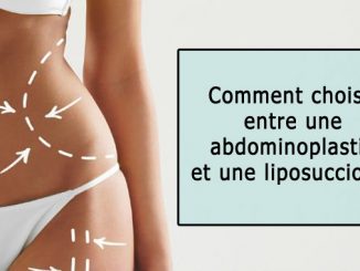 Choisir entre une abdominoplastie et une liposuccion