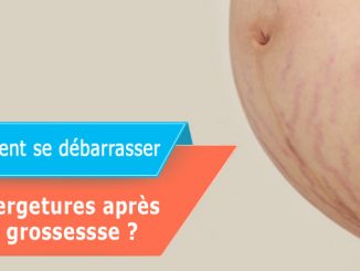 Comment se débarrasser des vergetures après une grossesse ?