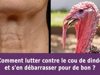 Lutter contre le cou de dinde