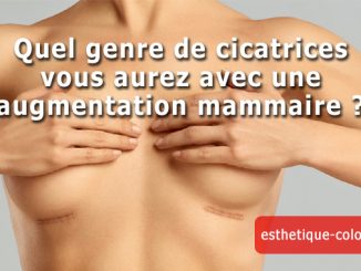 cicatrices augmentation mammaire
