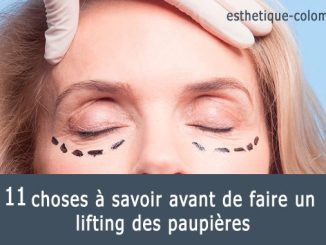 À savoir avant la blépharoplastie